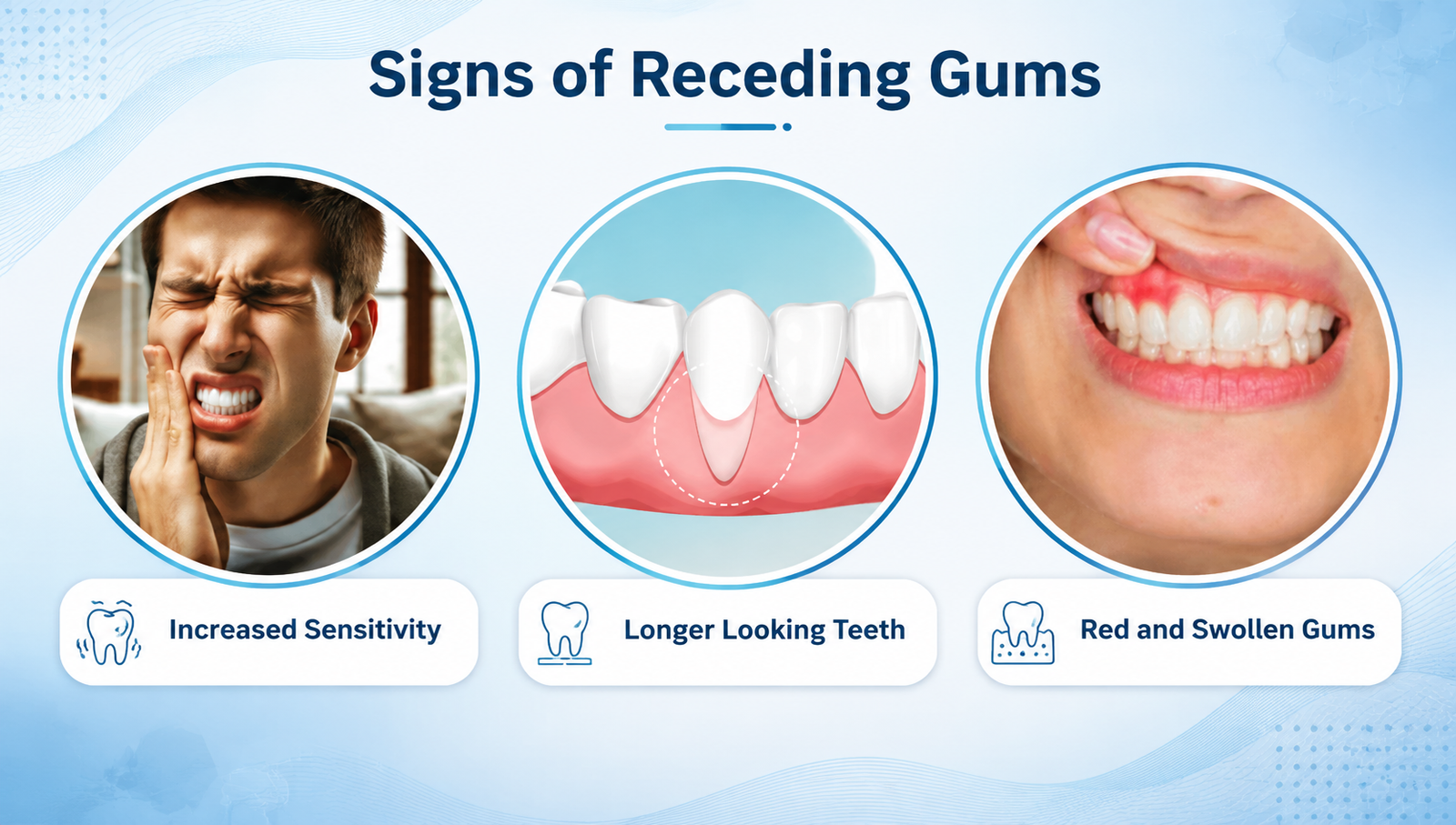 Signs of Receding Gums